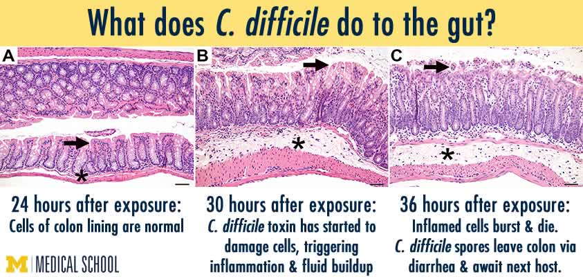 enlightening-health-wellness-info-c-diff